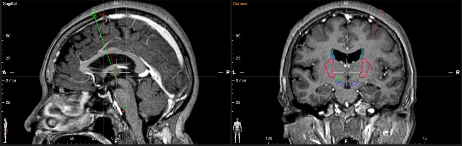 Angiógrafo de Médica Sur - Médica Sur Copyright